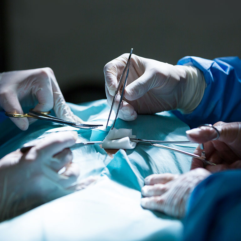 Hemorrhoids, Appendicitis, Hernia Operation